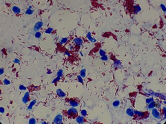 Estrutura bacteriana