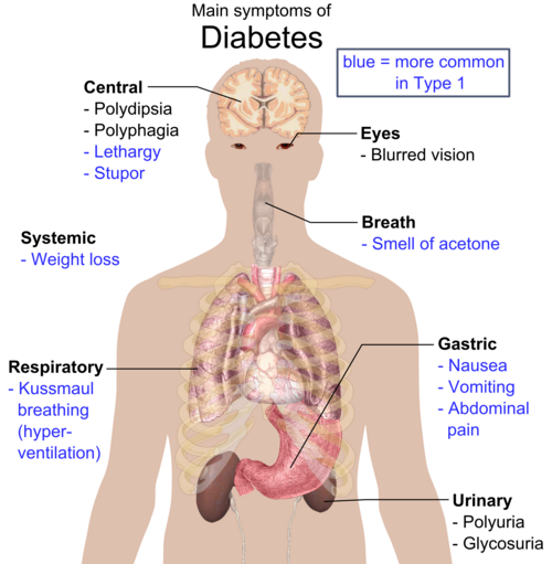 Gráfico ilustrando a progressão dos sintomas de diabetes